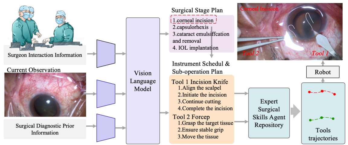 精灵科技-全自主眼科手术机器人 