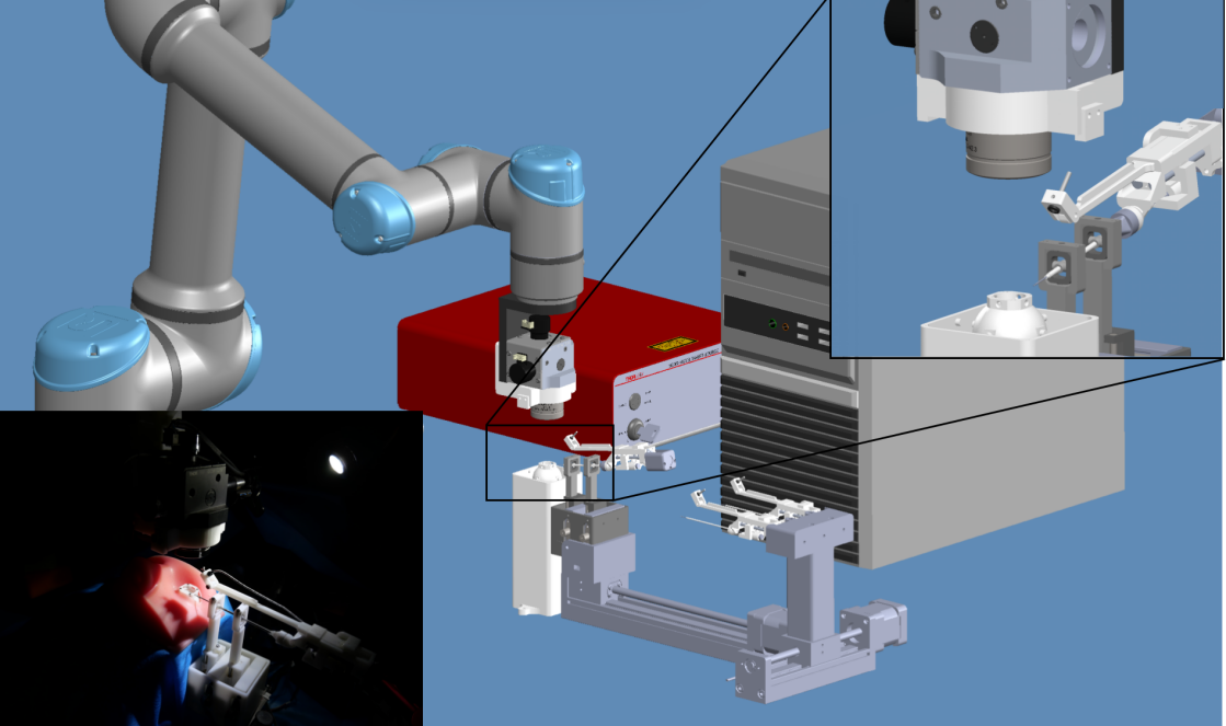 精灵科技-全自主眼科手术机器人 